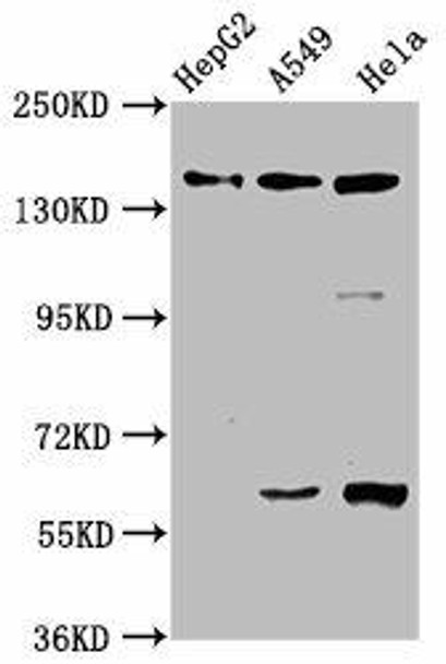 NAIP Antibody (PACO61890)