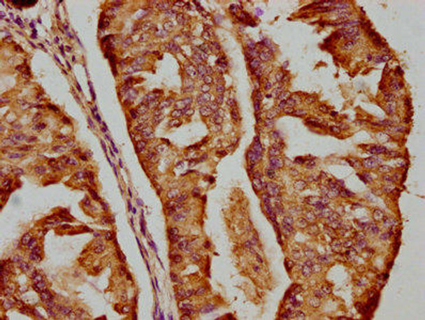 DICER1 Antibody (PACO62639)