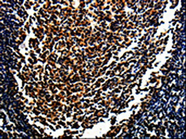 MAGEA4 Antibody (PACO13794)