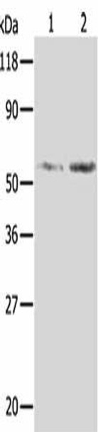 AKR1B1 Antibody (PACO13830)