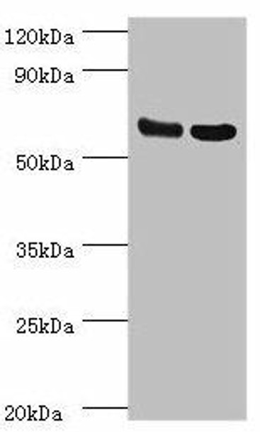 PDPK1 Antibody (PACO42903)