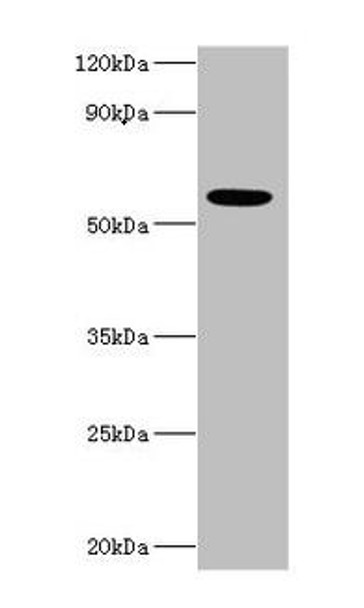 IFNAR2 Antibody (PACO42952)