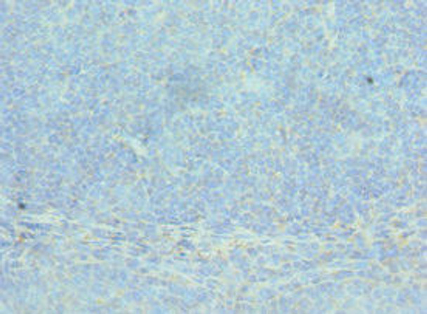 ACTR2 Antibody (PACO42974)