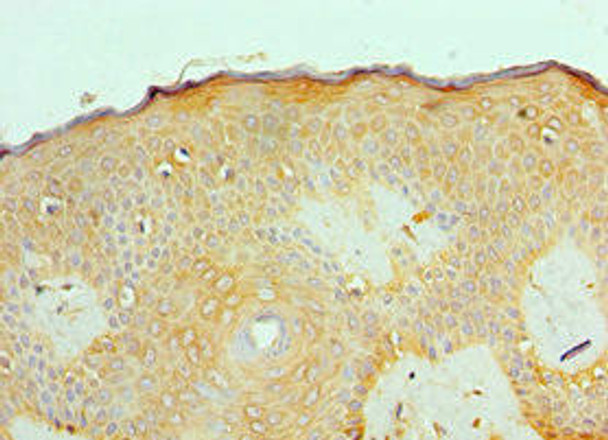 ACVR2A Antibody (PACO43117)