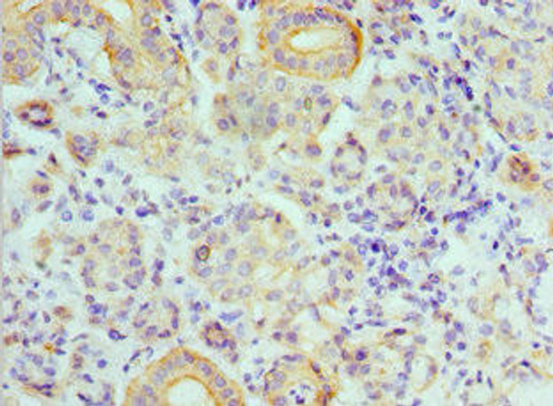 ATP6V1B1 Antibody (PACO43166)