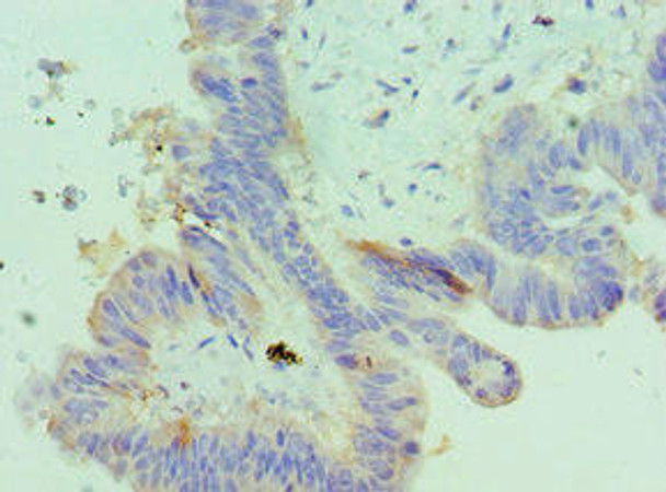 IGFBP4 Antibody (PACO43201)