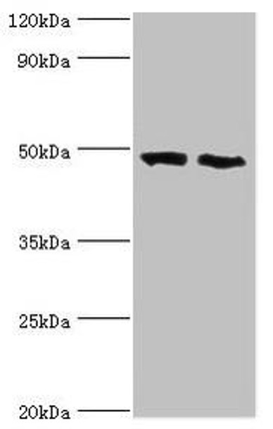 FDFT1 Antibody (PACO43235)