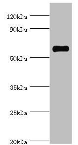 SRSF4 Antibody (PACO43346)