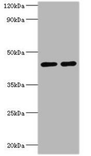 SIRT3 Antibody (PACO43375)
