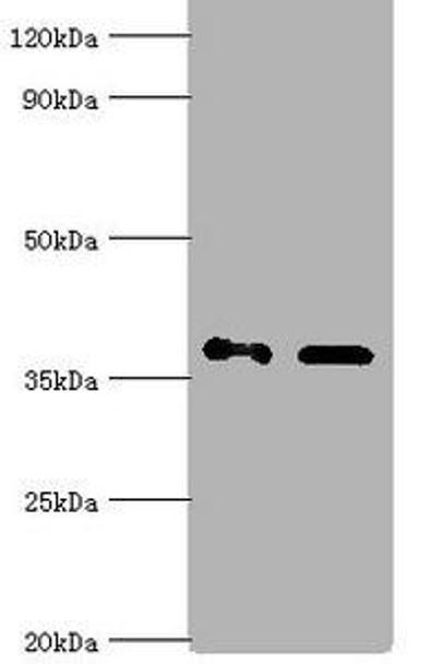 AKR1C4 Antibody (PACO43423)