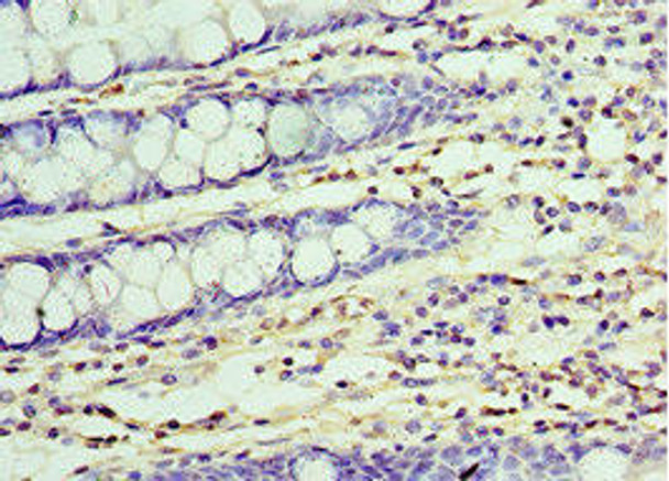 UCHL3 Antibody (PACO43772)