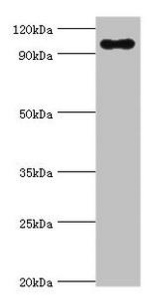 TGS1 Antibody (PACO43840)