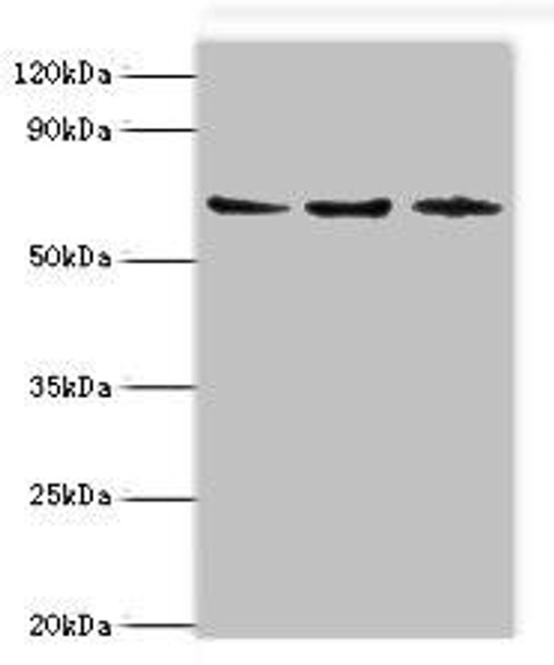 ACAD9 Antibody (PACO44099)