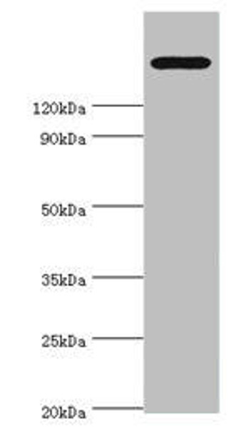 TRPM2 Antibody (PACO44120)