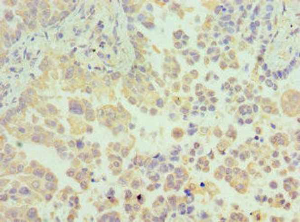 N6AMT1 Antibody (PACO44124)