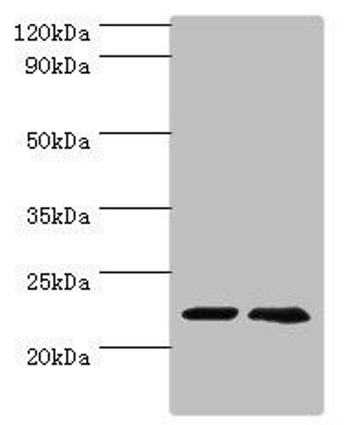 ASF1A Antibody (PACO44132)