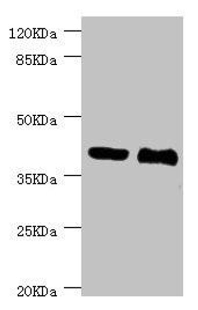 NHLRC1 Antibody (PACO44356)