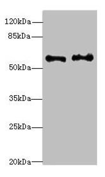 NMT2 Antibody (PACO44512)