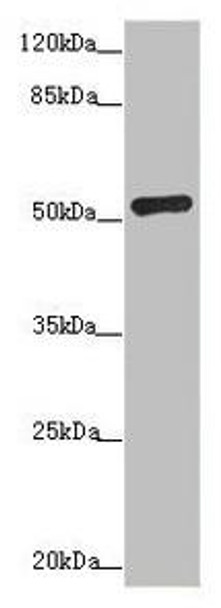 ADPGK Antibody (PACO44603)