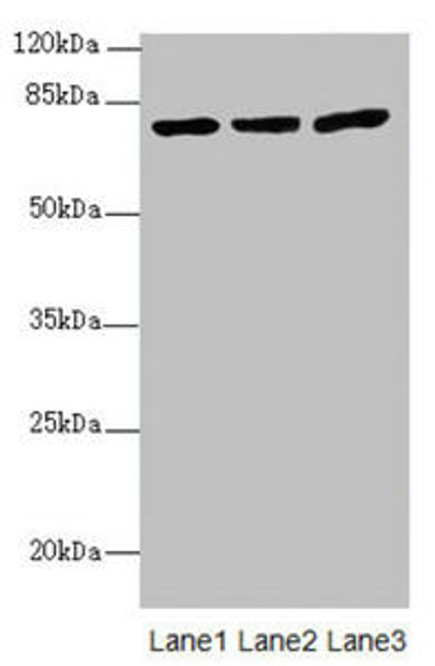 KBTBD7 Antibody (PACO44647)