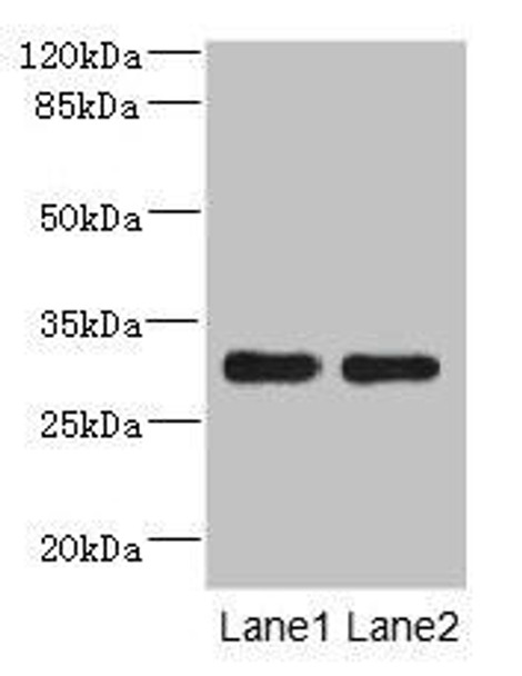 DRAM2 Antibody (PACO44804)