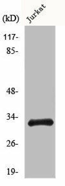 CCNB1IP1 Antibody (PACO00901)