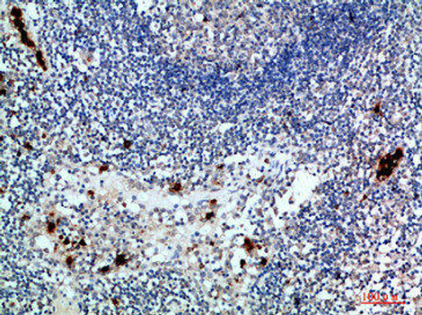 ZAP70 Antibody (PACO07389)