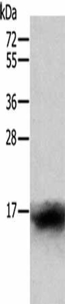 CCL24 Antibody (PACO14209)