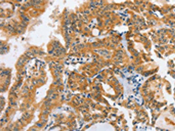 DDX58 Antibody (PACO19242)