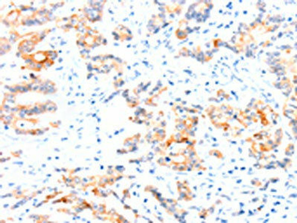 CCDC88A Antibody (PACO19280)