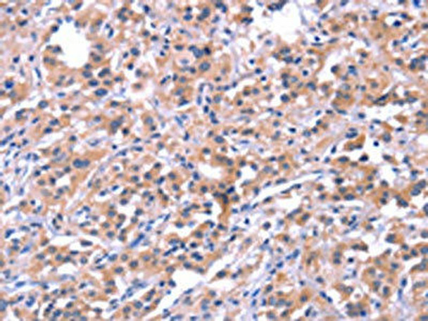 EP300 Antibody (PACO19604)