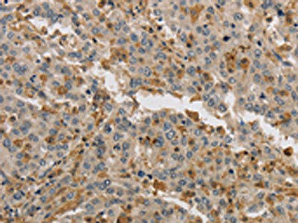 KIF17 Antibody (PACO19899)