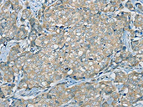 SERPINA11 Antibody (PACO20444)