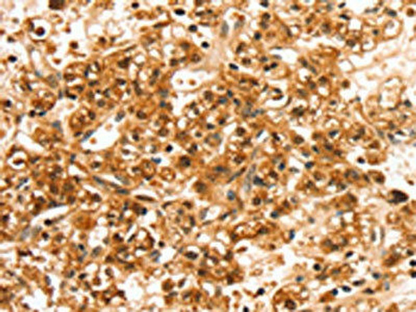 SLC44A2 Antibody (PACO20515)