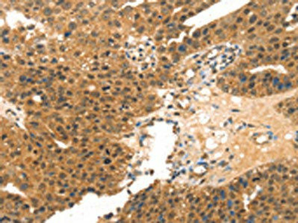 MED14 Antibody (PACO20755)