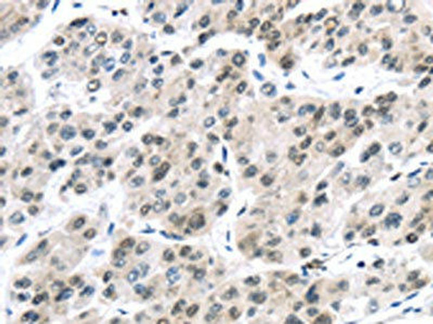 DDX39B Antibody (PACO20802)