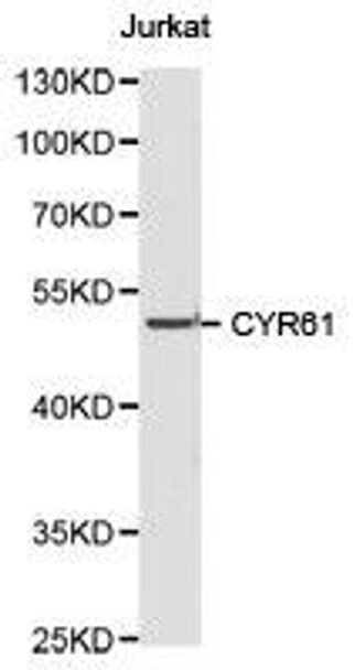 CYR61 Antibody (PACO21078)