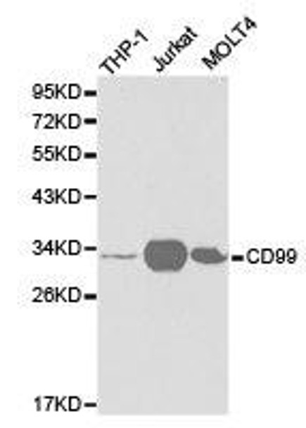 CD99 Antibody (PACO21219)