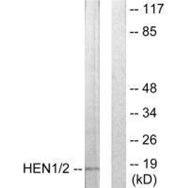 NHLH1/NHLH2 Antibody (PACO21822)