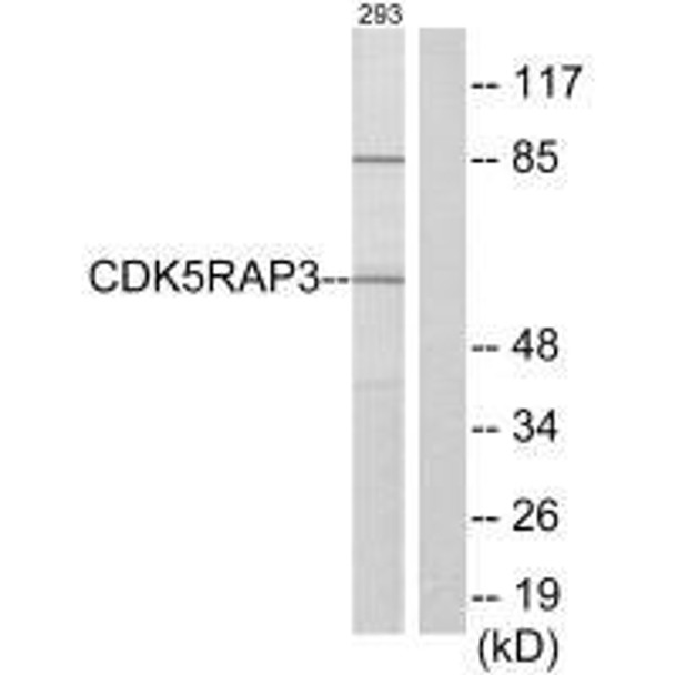 CDK5RAP3 Antibody (PACO22033)