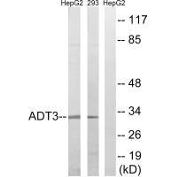 SLC25A6 Antibody (PACO22124)