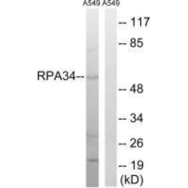 CD3EAP Antibody (PACO22311)