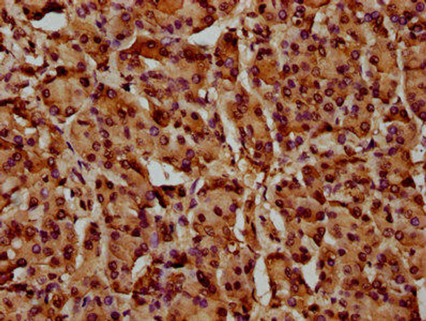 HIST1H4A (Ab-88) Antibody (PACO59616)