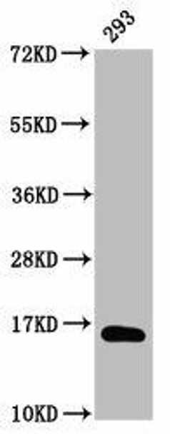 beta -hydroxybutyryl-HIST1H3A (K9) Antibody (PACO60525)