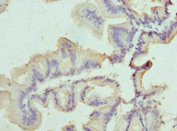 SLC25A20 Antibody (PACO44277)