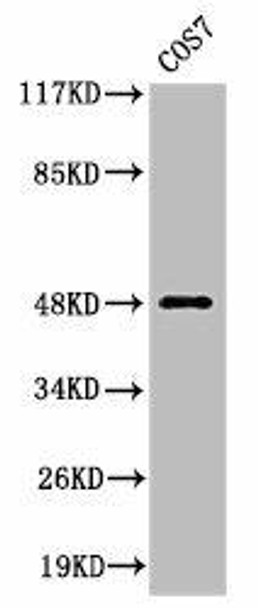 Cleaved-MMP27 (Y99) Antibody (PACO00037)