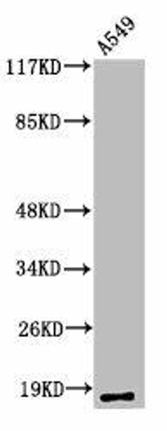 Cleaved-MMP1 (F100) Antibody (PACO00054)