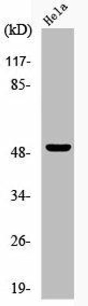 Phospho-GSK3A (S21) Antibody (PACO00215)