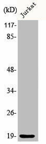 Phospho-STMN1 (S25) Antibody (PACO00245)