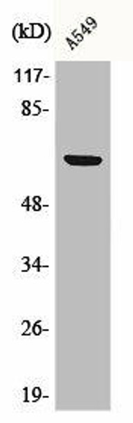 Phospho-RPS6KB1 (S447) Antibody (PACO00257)